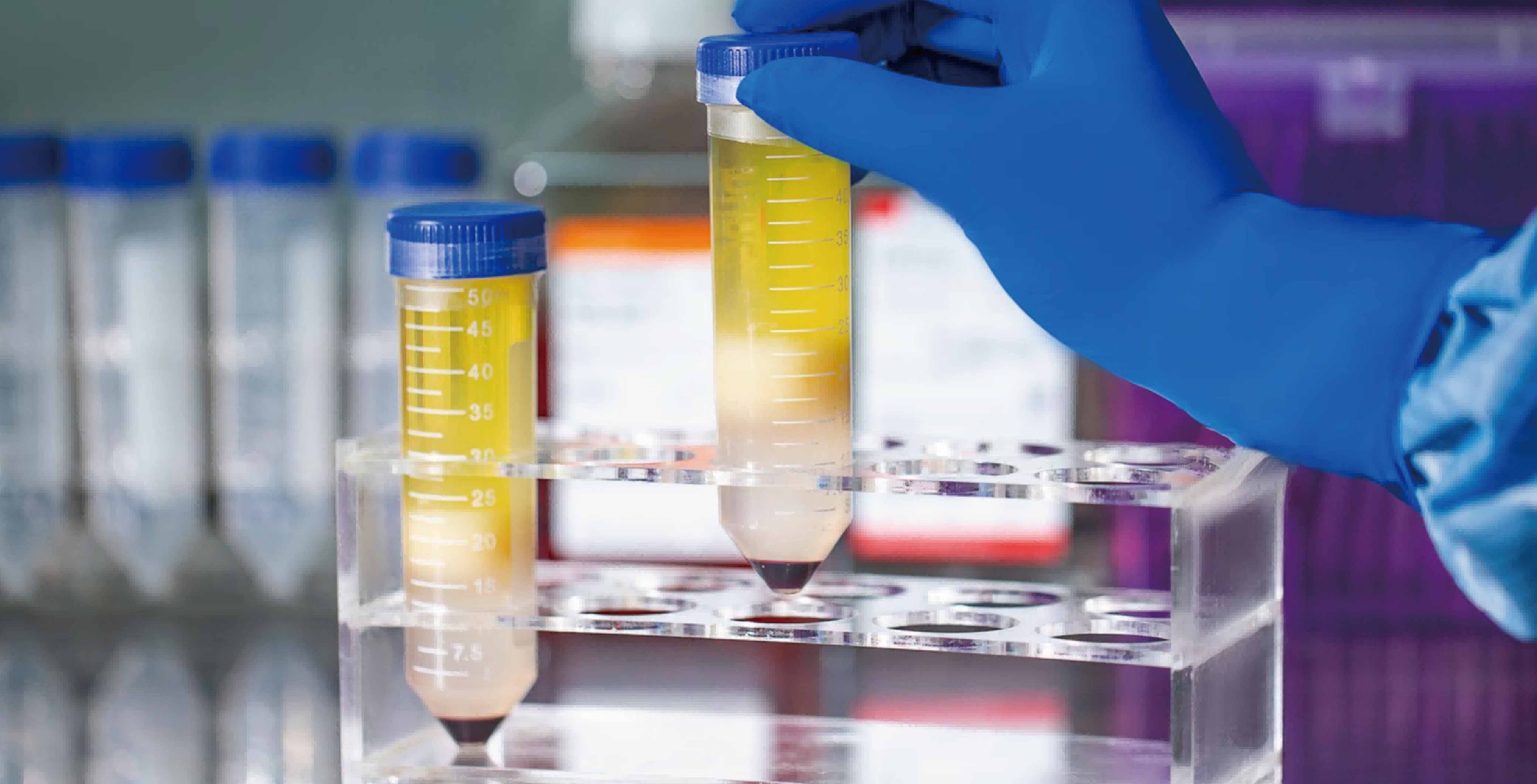 新品上市 | 解离的肿瘤原代细胞（DTCs）分离冻存服务