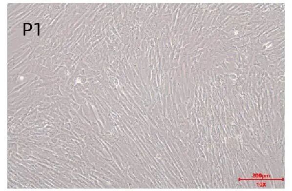 新品上市｜必赢国际bwi437推出人间充质干细胞分离服务(图3)