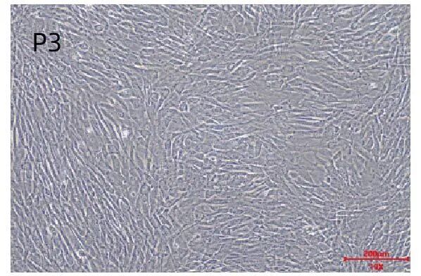 新品上市｜必赢国际bwi437推出人间充质干细胞分离服务(图5)