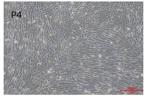 新品上市｜必赢国际bwi437推出人间充质干细胞分离服务(图6)
