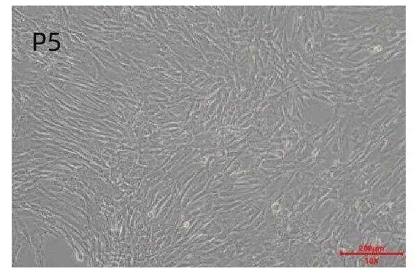 新品上市｜必赢国际bwi437推出人间充质干细胞分离服务(图7)